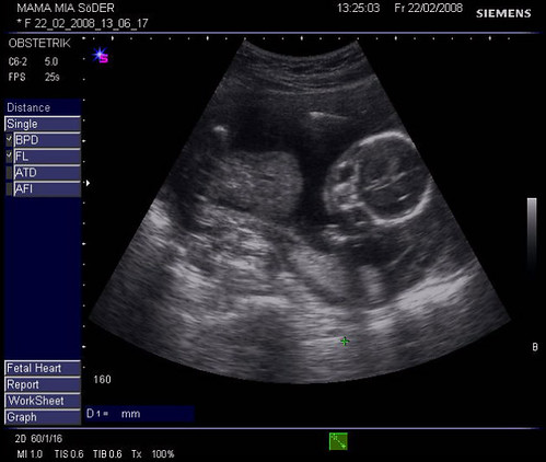 ultrasound 1