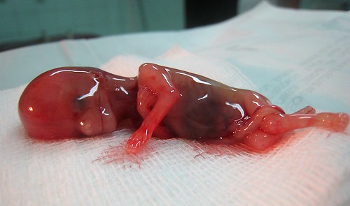 Fetus At 9 Weeks. Well here is one at 16 weeks.