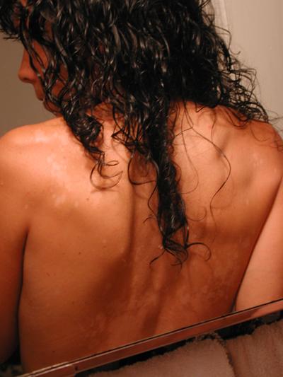 my back thing.