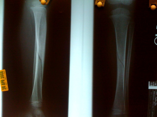 the new x ray