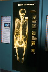 X-Ray of a Mummy