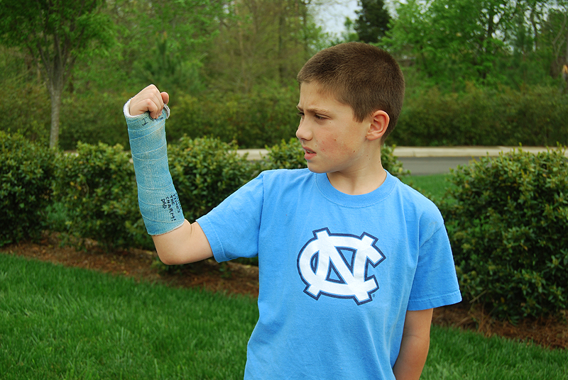 Right Arm Cast