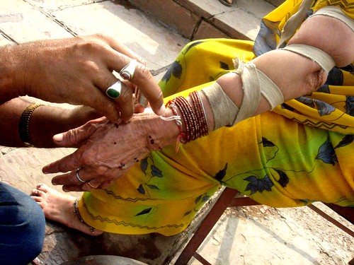 Blood Letting in Old Delhi | Flickr - Photo Sharing!
