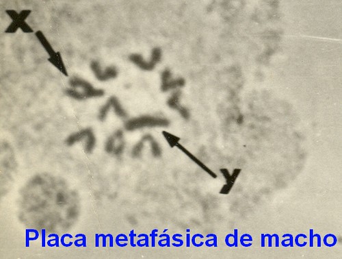 Placa metafásica de macho da D.nappae