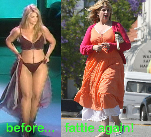 before and after fat