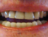 Detail sur dents pour web et blog