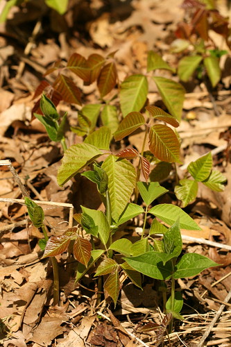 poison ivy rash treatment. Poison Ivy