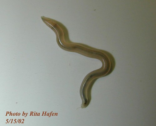 worms in humans. The filaria worm causes