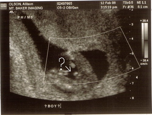3d ultrasound 20 weeks boy. 14 weeks pregnant ultrasound