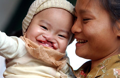 Operation Smile. World Jorney of Smiles. Mae Sot, Thailand. Nov. 2007