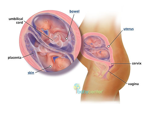 Twin babies, fetuses at 20 weeks - BabyCenter