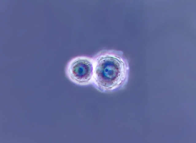 Choanoflagellate cysts o0