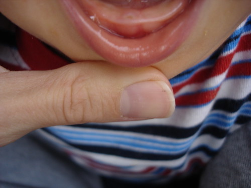 Ethan's tooth