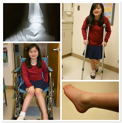 Sophia's Ankle Injury