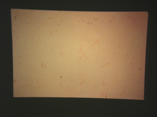 staphylococcus aureus gram stain. Proteus Vulgaris gram