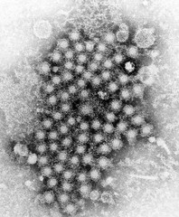 Hepatitis virions, of an unknown strain of the...