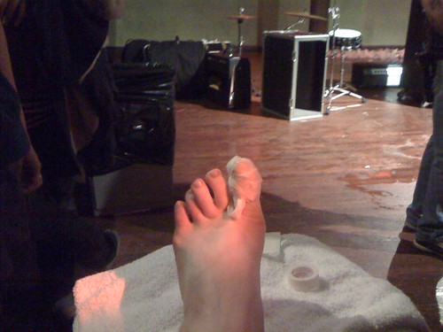 my toe, josh's handiwork