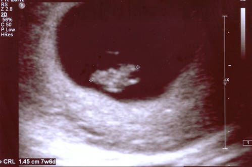 baby number 2a