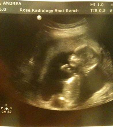 15 weeks ultrasound