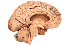 Human brain, medial view