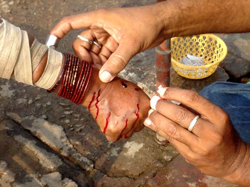 Blood Letting in Old Delhi The aftermath