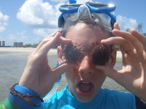 sea urchin eyeballs