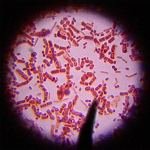 Escherichia coli im Lichtmikroskop. (Foto: kaibara87 auf flickr.com)