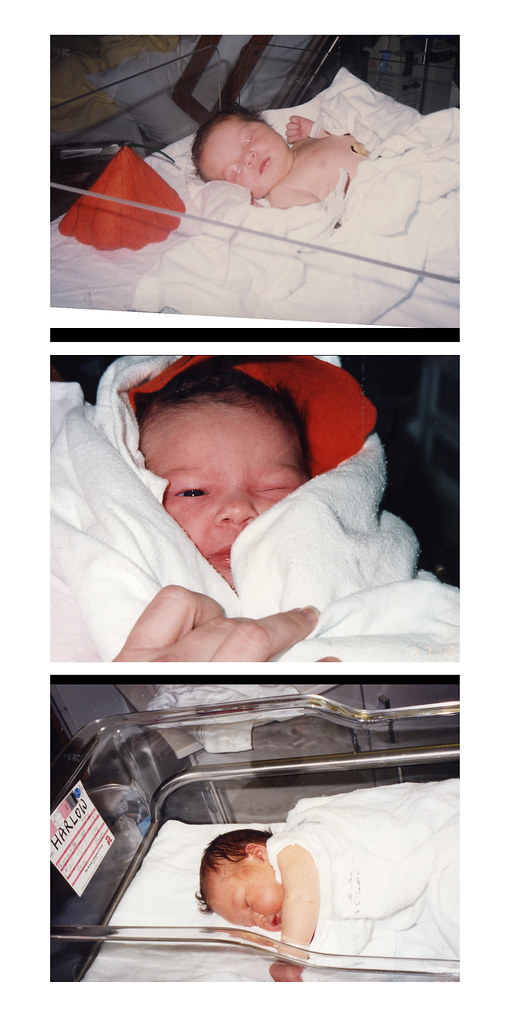 1993 - Baby Rachel