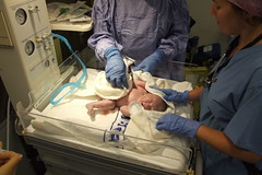During the c-section