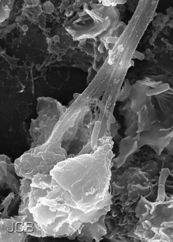 Bacterial capture by Neutrophil NETs
