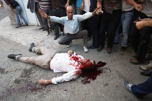 Iranian demonstrator killed in todays demonstration (APTOPIX)