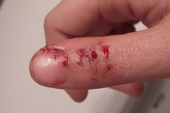 my thumb (front)