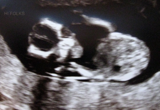 Baby - November 30 (Click to enlarge)