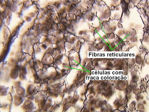 Tecido conjuntivo reticular
