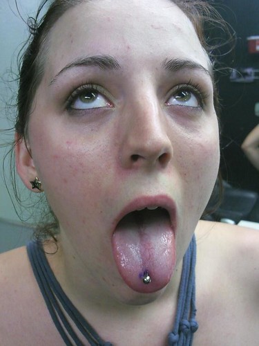 spider bites in florida with pictures. spider bite piercing pictures.