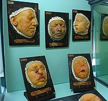 From The museum of Medical Instruments from the Hospitals of Toulouse