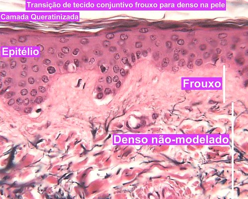 Transição de tecido conjuntivo frouxo para denso na pele