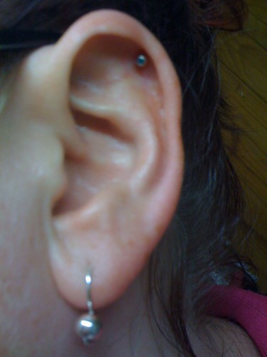 piercing infection. A simple ear piercing