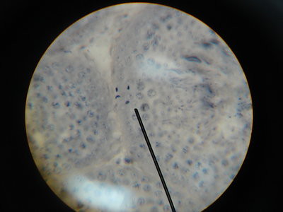 Animal Cell In Prophase. animal cell prophase. animal