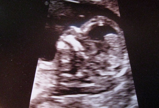 Baby - November 24 - picture 2 (Click to enlarge)
