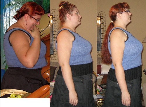 before and after hcg diet. Before After After