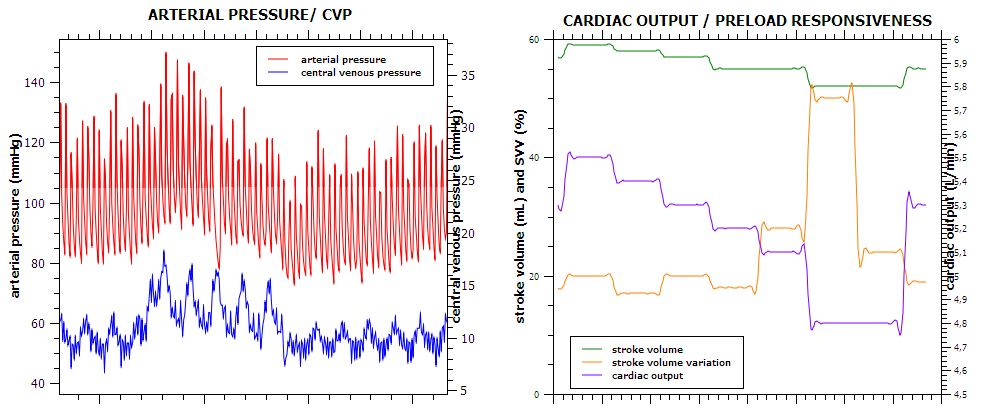 Cardiac output and stroke volume 
