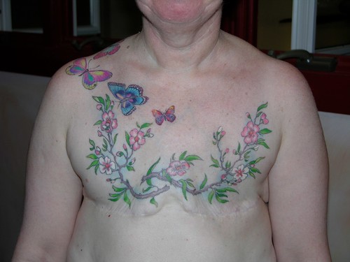 After Breast Cancer Tattoo