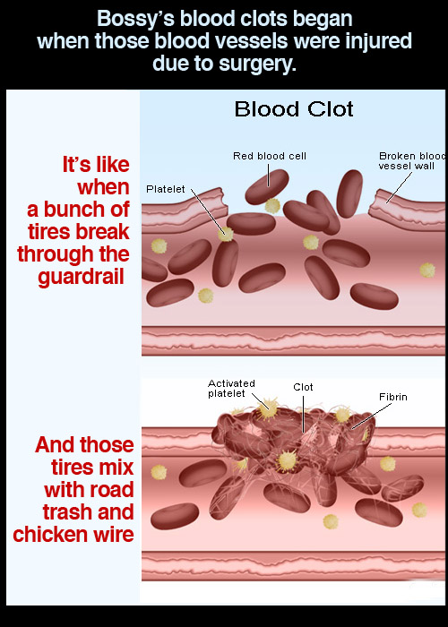 blood-clot-diagram