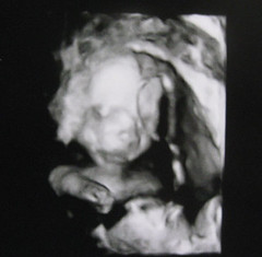 Our Baby's Face