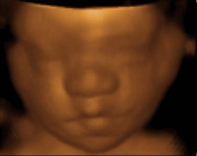 3d ultrasound pictures at 20 weeks. 3d ultrasound 20 weeks boy.