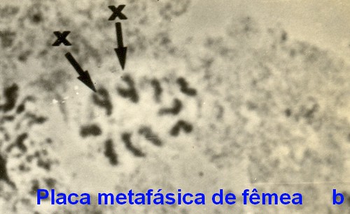 Placa metafásica de femea (2) da D.nappae