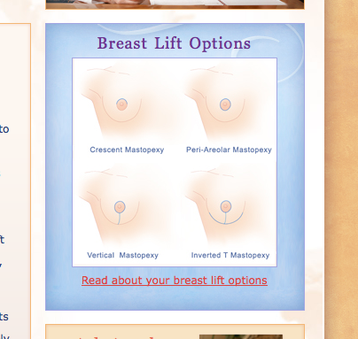 Breast Lift Options Picture from Parker Center for Plastic Surgery New Jersey