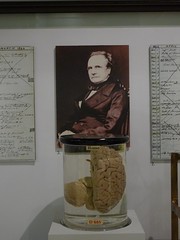 Babbage and His Brain