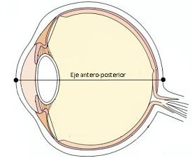 Esquema del ojo para mostrar ek eje antero-posterior del ojo y así entender la miopía magna